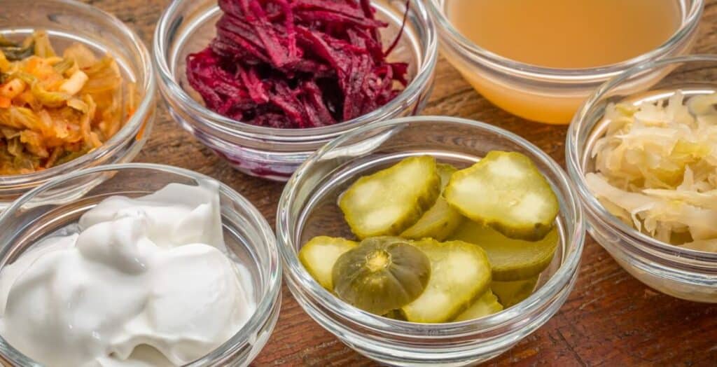 10 Fermented Foods That Will Boost Your Gut Health
